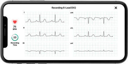 KardiaMobile 6L Personal EKG Monitor With Most Smartphones