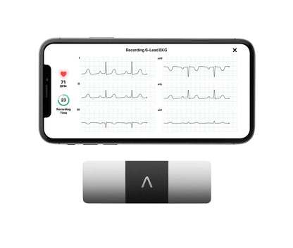 KardiaMobile 6L Personal EKG Monitor With Most Smartphones